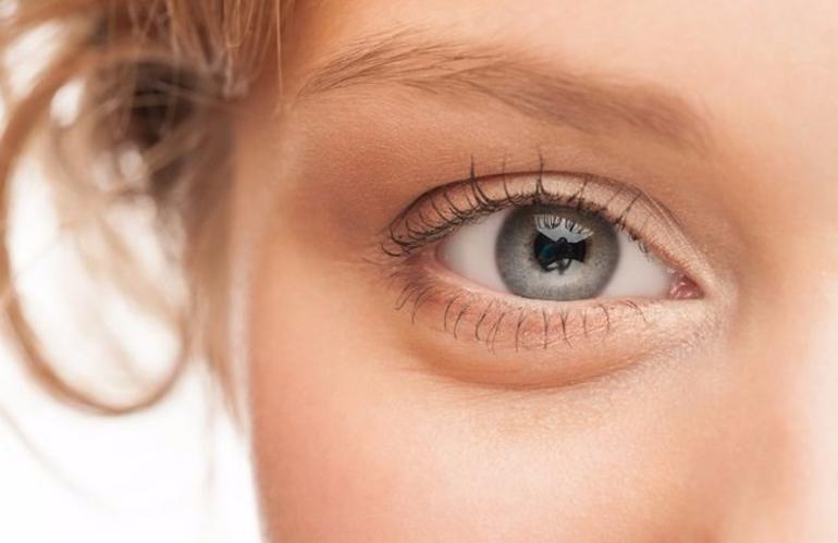 5 طرق لعلاج انتفاخات العيون