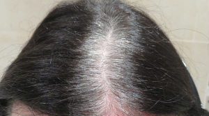 طريقة استخدام البصل لعلاج الشعر الأبيض